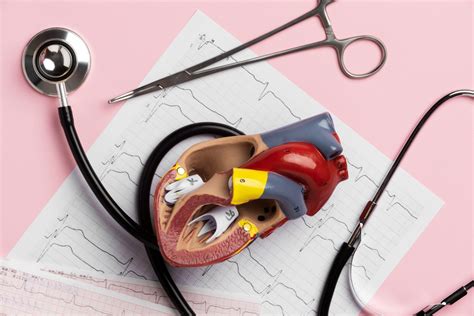 Infografika: priežastys ir prevencija nuo iššutimų