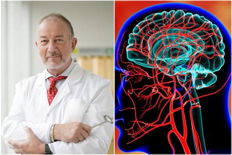 Schematinis vaizdas: galvos smegenų kraujotaka ir galimi sutrikimai