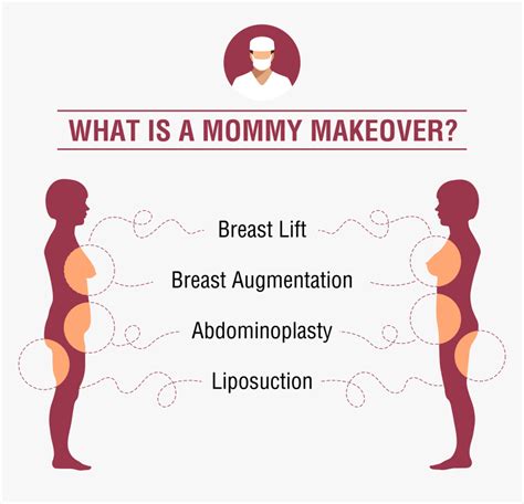 Schematiškas „Mommy Makeover“ operacijos pavyzdys