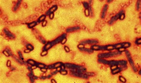 Listeria bakterijos mikroskopinis vaizdas