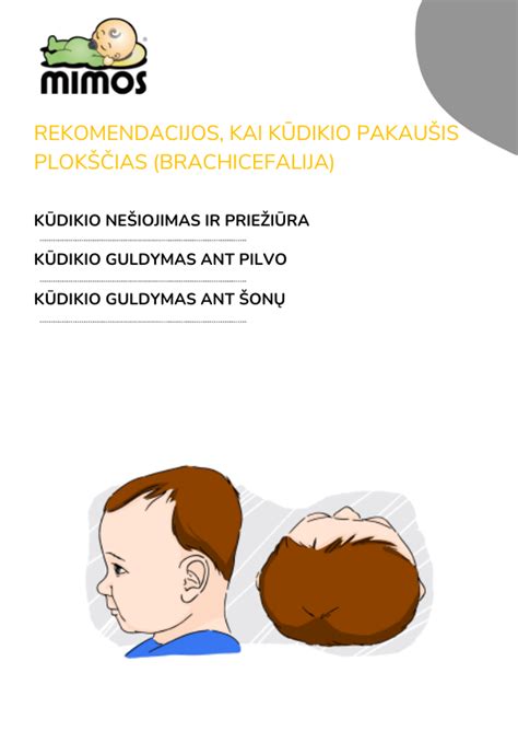 Kūdikio galvytės formos palyginimas