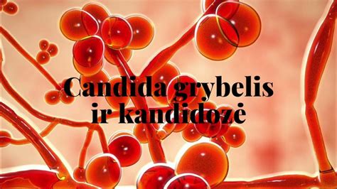 Mikroskopiškai matomas Candida grybelis