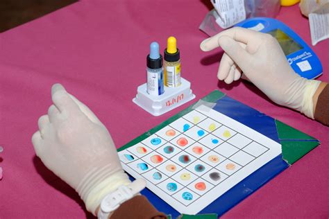 Rh faktoriaus neatitikimas nėštumo metu