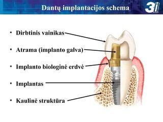 Schema, vaizduojanti implantacijos procesą