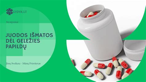 Juodos išmatos