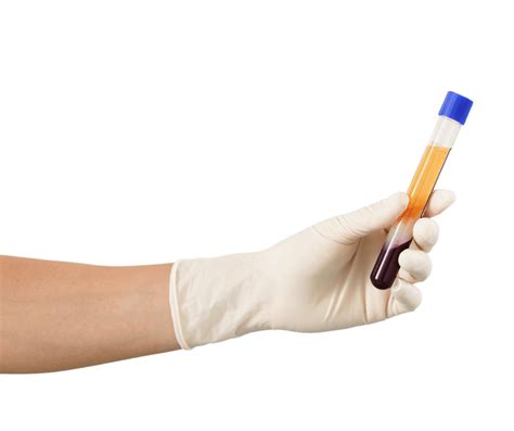 Vaiko ranka laiko pipetę su mėginiu mikroskopui