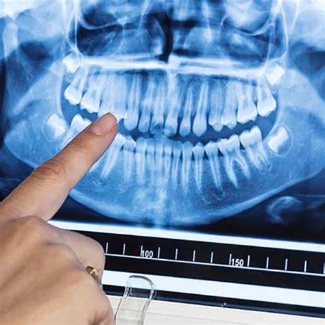 Rentgeno tyrimų grafikas