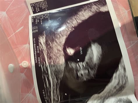 Liaudiški vaiko lyties nustatymo metodai