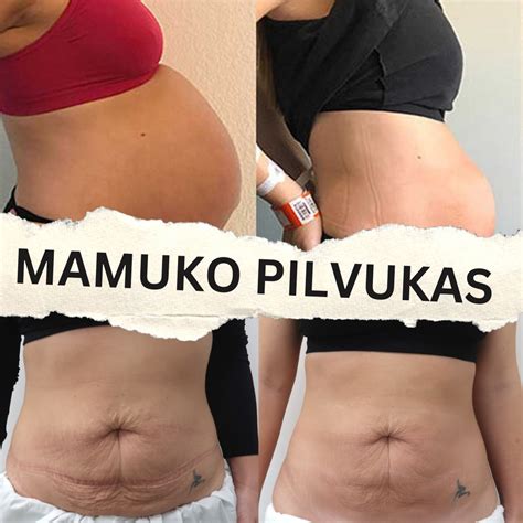 Nėščiosios kūnas ir pilvo pokyčiai