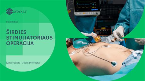Širdies stimuliatoriaus implantavimo schema