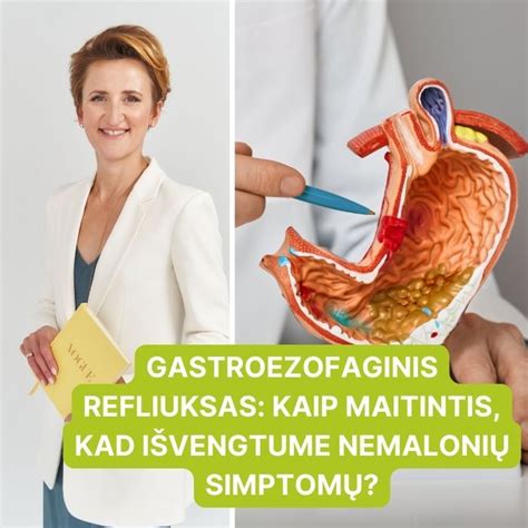 Schema, kaip veikia gastroezofaginis refliuksas