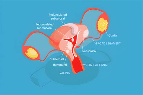 anatomija - gimda ir kiaušintakiai