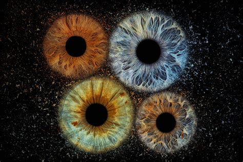 Kūdikių akys su konjunktyvitu