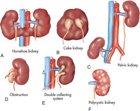 schema illustrating the development of infant kidneys