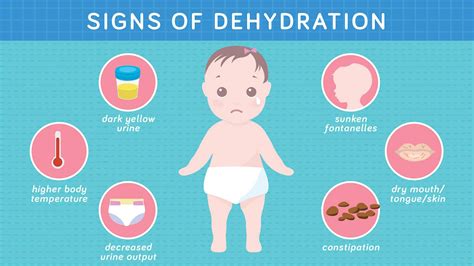 infographic on signs of infant dehydration