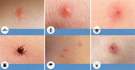 Vabzdžių geluonių tipai