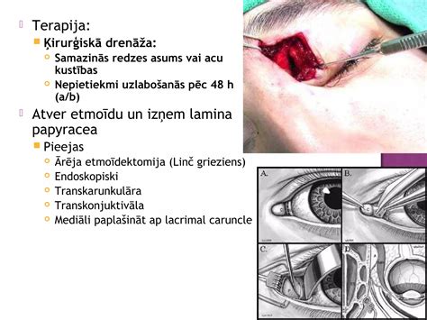 Infografika, iliustruojanti dažniausias daugiavaisio nėštumo komplikacijas