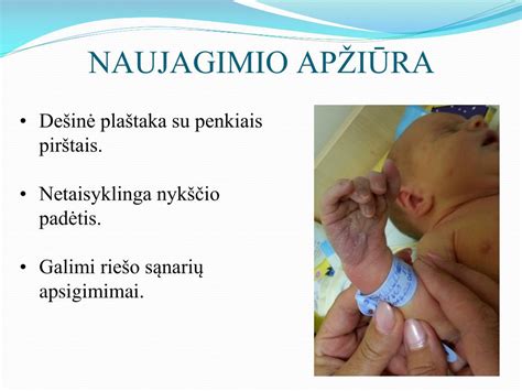 Naujagimio apžiūra su Apgar skale