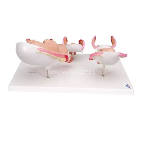 3D nėštumo modelis