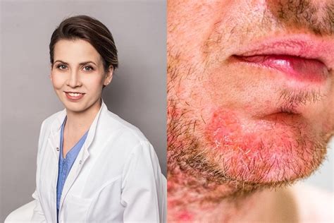 Veiksniai, galintys sukelti atopinį dermatitą