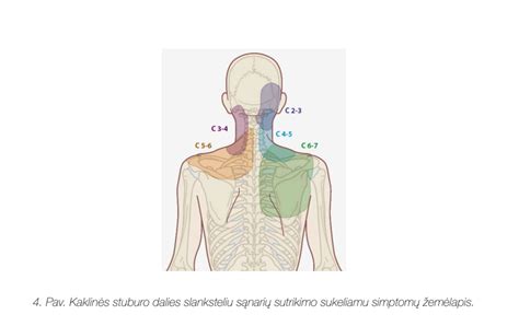 Scheminis kaklo stuburo vaizdas su pažymėtais slanksteliais, diskais ir raumenimis