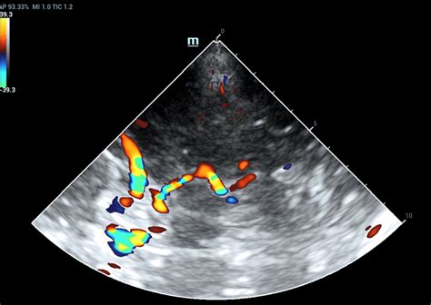 ultragarsinio tyrimo vaizdas