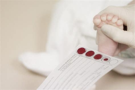 Naujagimio kraujo paėmimas iš kulno