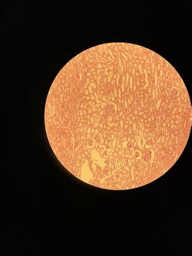 Mikroskopinis vaizdas: vitrifikuotas embrionas