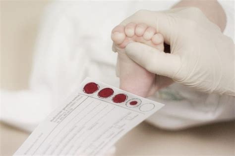 Naujagimio kraujo paėmimo procesas