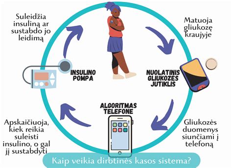 Dirbtinės kasos sistema ir gliukozės matuoklis