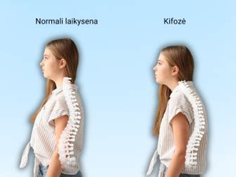 Nėščiosios laikysena ir stuburo apkrova
