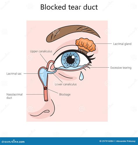 schema of tear duct system