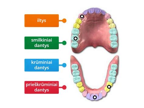 Palyginimas: sveiki dantys ir dantys su kariesu