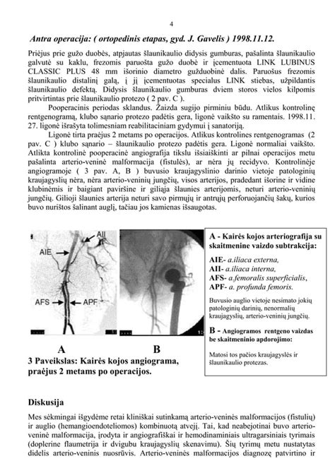 Schema: Chirurginio gydymo metodai esant šlapimo nelaikymui