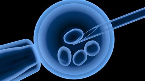 Procedūra in vitro fertilizacija (IVF)
