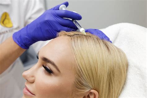 Plaukų slinkimo gydymo būdai