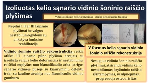 Vaizdinė schema: Epiziotomija ir tarpvietės plyšimas