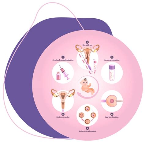 scheminis IVF proceso pavaizdavimas