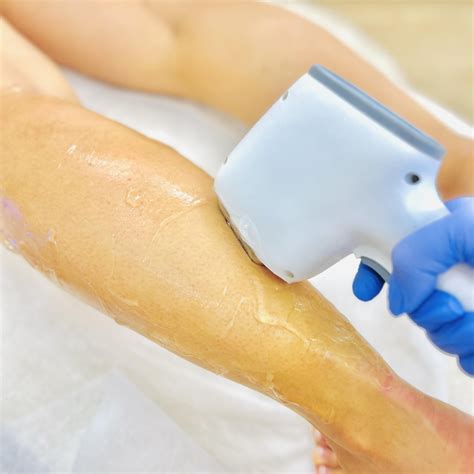 saugūs plaukelių šalinimo metodai nėštumo metu