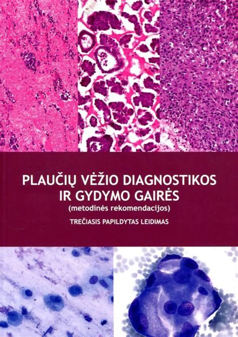 Plaučių diagnostikos ir gydymo schema