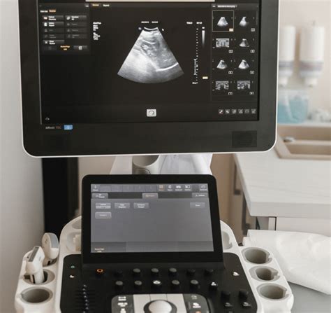 Echoskopijos prietaiso scheminis vaizdas