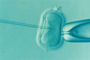 Statistika apie IVF sėkmės rodiklius