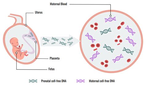 Neinvazinio prenatalinio tyrimo (NIPT) schema