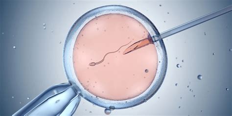 IVF procedūros eigos schema