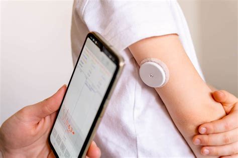 Nuolatinis gliukozės monitorius (CGM)