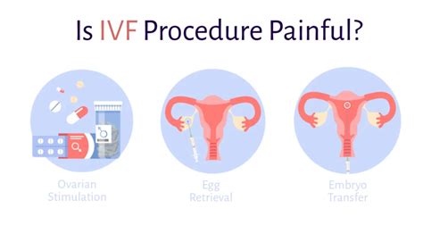Vizualizacija IVF procedūros etapų