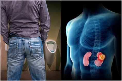 Simptomai, rodantys inkstų problemas