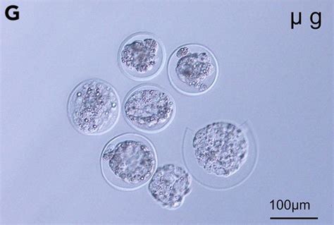 blastocistos vystymasis