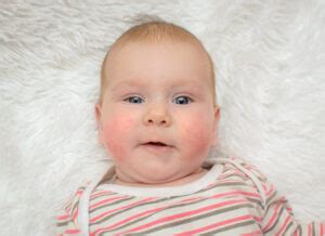 Balkšvų kūdikio išmatų nuotrauka