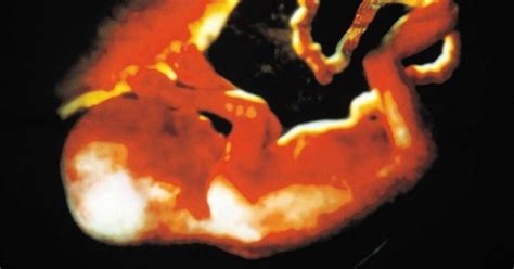 vaisiaus judesiai nėštumo metu